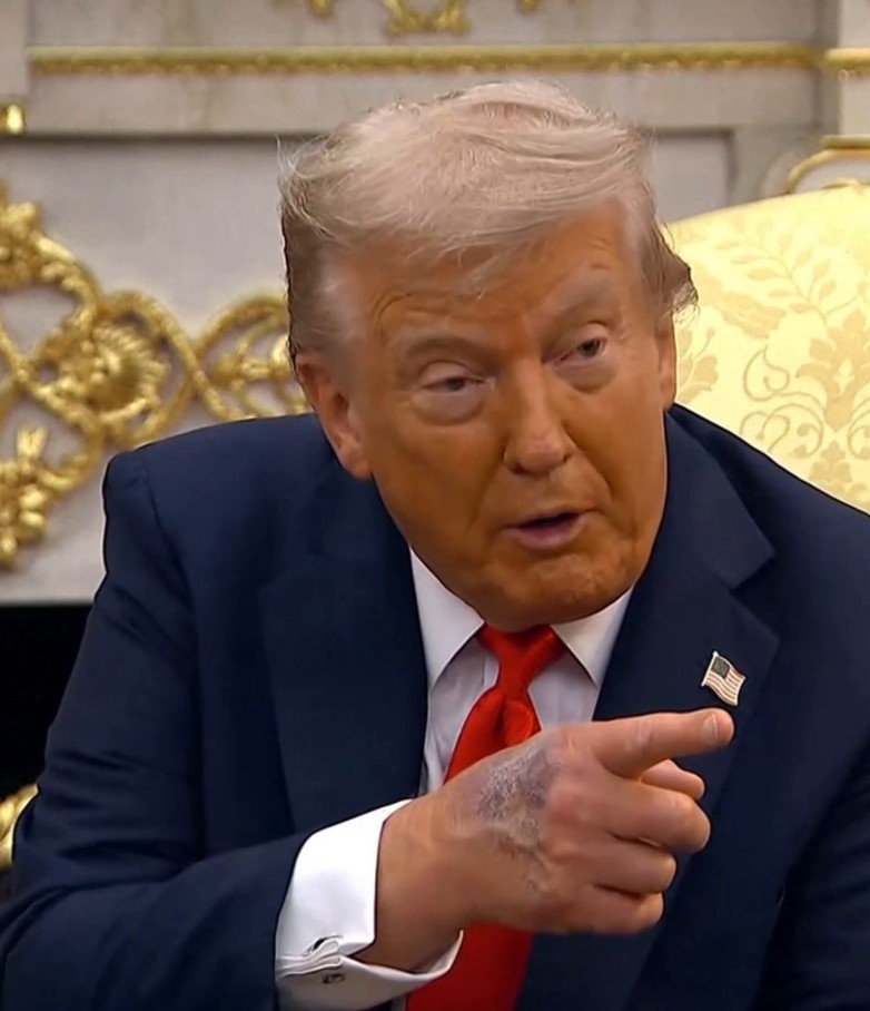 Concerns and questions grow over President Trump’s health